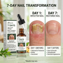 Nail Fungus Treatment Liquid for Healthier-Looking Nails