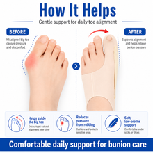 ToeFix Elastic Bunion Sleeve