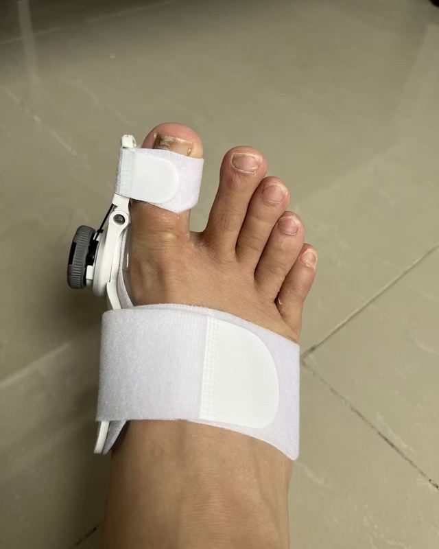 Linda M. ToeFix customer photo